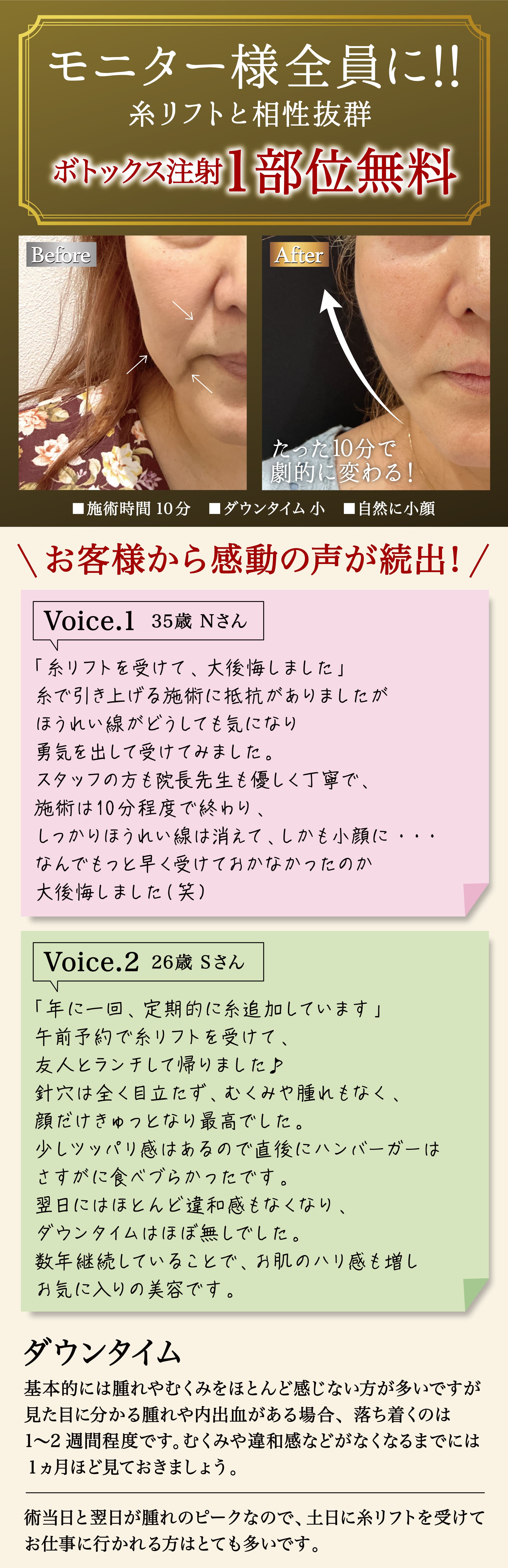モニター様全員に！！糸リフトと相性抜群！ボトックス注射1部位無料