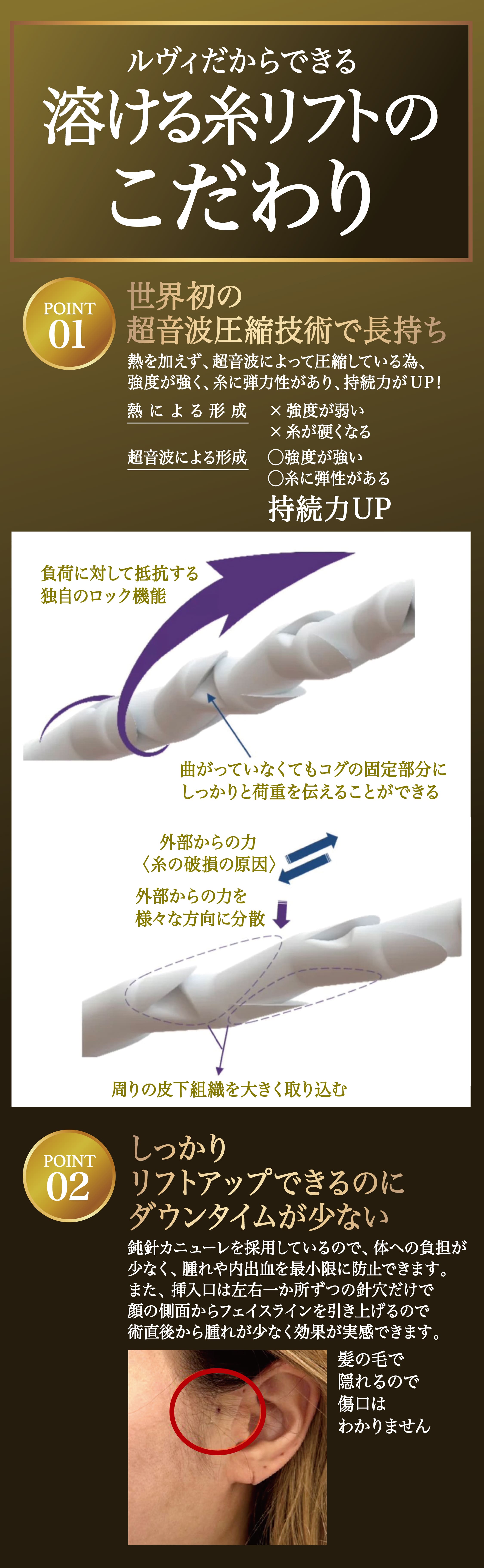 ルヴィだからできる溶ける糸リフトのこだわり